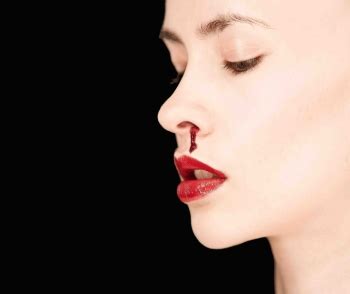 Bloody Nose Causes and How to Stop a Bloody Nose | The Celebrity Nose Jobs Before and After