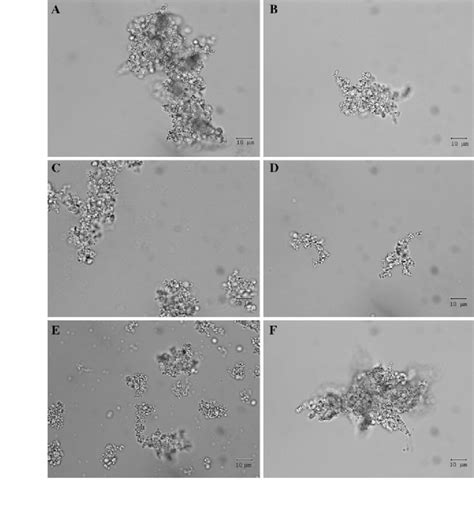 Light-microscopy visualization of human platelet aggregates formed in... | Download Scientific ...