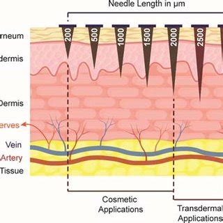 Variations of the needle length in derma rollers and their application ...