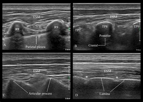 Ultrasound sequence to identify the relevant sonoanatomy at the target ...