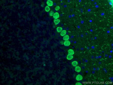 Calbindin-D28k antibody (66394-1-Ig) | Proteintech