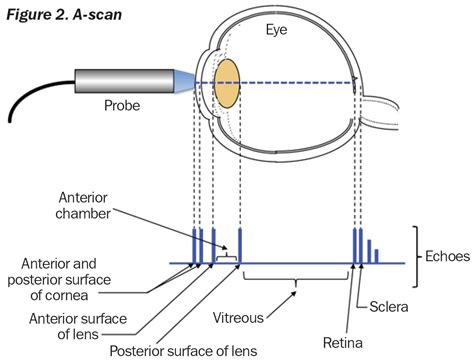 A-Scan diagram-IOLmaster | Pharmacology nursing, Medical terminology study, Optometry school