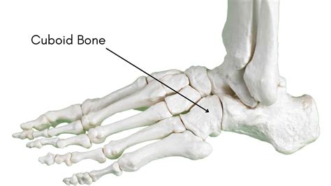 Cuboid Fracture | Cuboid Bone Fracture: Symptoms and Treatment