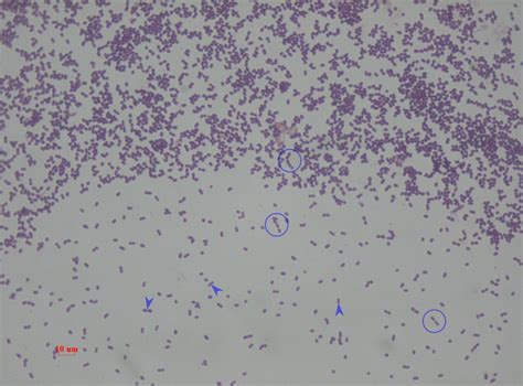 Enterobacter Aerogenes Gram Stain