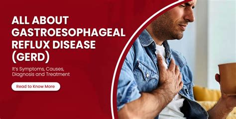 Gastroesophageal Reflux Disease (GERD): Symptoms, Causes, Diagnosis and Treatment