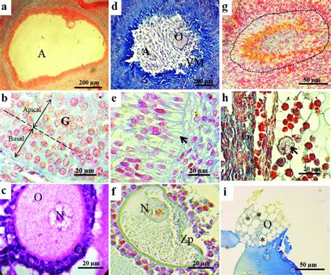 Histology of atretic antral follicles showing early and late stages of... | Download Scientific ...