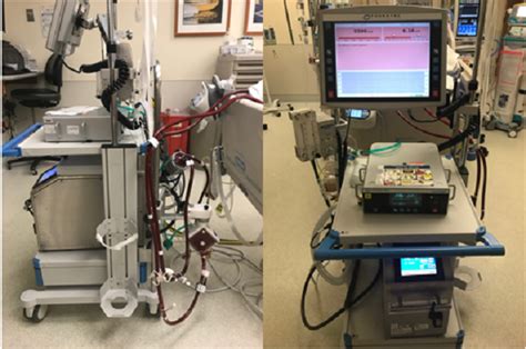 VV ECMO | The Patient Guide to Heart, Lung, and Esophageal Surgery