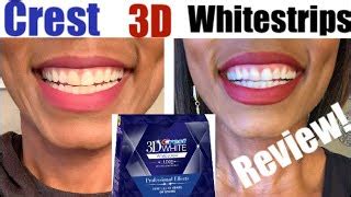 do crest whitening strips work on fillings - Very Nice To Look At Forum Picture Archive