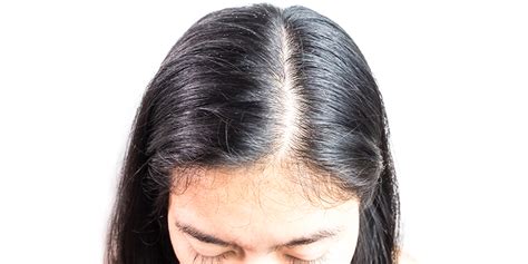 How To Remove Excess Sebum From Scalp: Causes And Tips