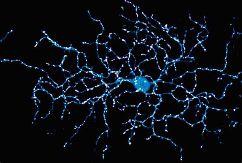 Microscopy technique homes in on links between neurons | Spectrum | Autism Research News