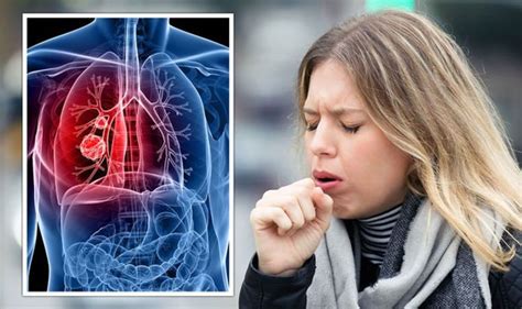 Lung cancer symptoms: Five of the most common signs of lung cancer ...