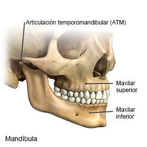 Fractura De Mandibula