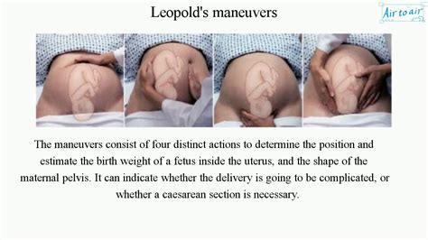 Leopold's maneuvers - YouTube