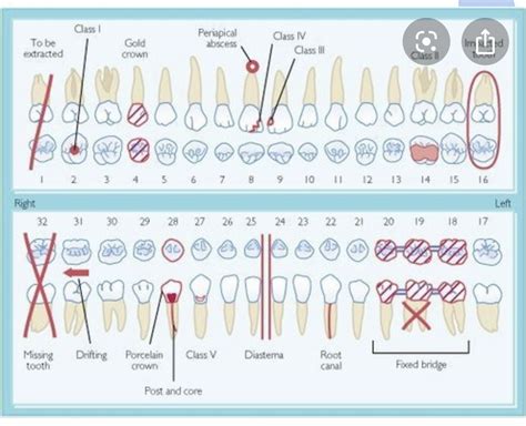 Dental Charting Symbols Chart