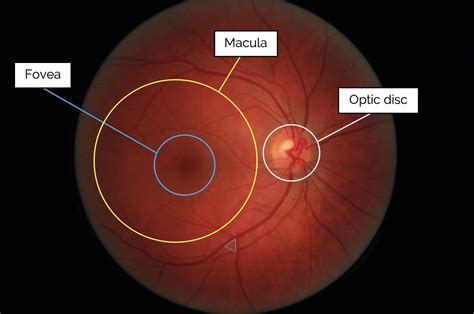 Macular Degeneration - Prompt Treatment | myeyespecialist