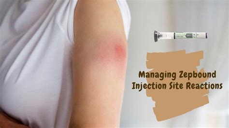 Managing Zepbound Injection Site Reactions: Tips and Solutions