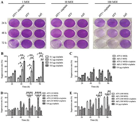 Plaque formation assay by crystal violet staining and cell... | Download Scientific Diagram