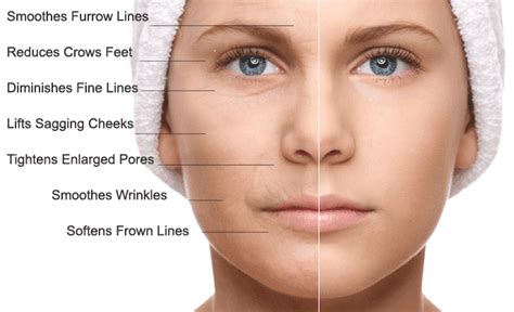 Stem Cell/PRP Facial Rejuvenation - New Image Advanced Laser Skin ...