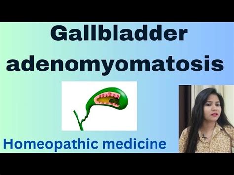 Gallbladder adenomyomatosis treatment ! Adenomyomatosis symptoms,cause ...