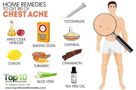 Home Remedies to Get Rid of Chest Acne | Top 10 Home Remedies