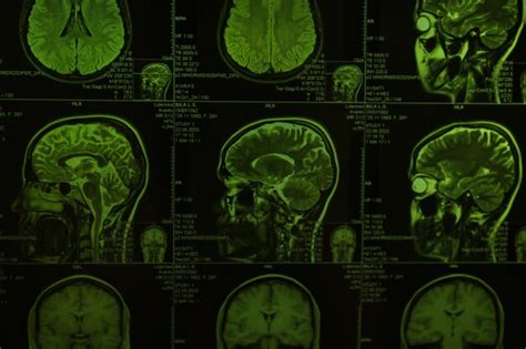 Premium Photo | Mri or magnetic resonance imaging of the head and brain in green light closeup