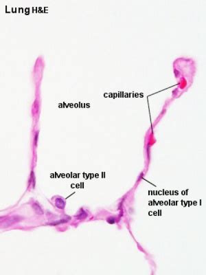 File:Alveolar-sac-01.jpg - Embryology