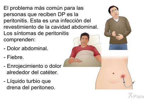 PatEdu.com : Acceso de catéter para diálisis peritoneal