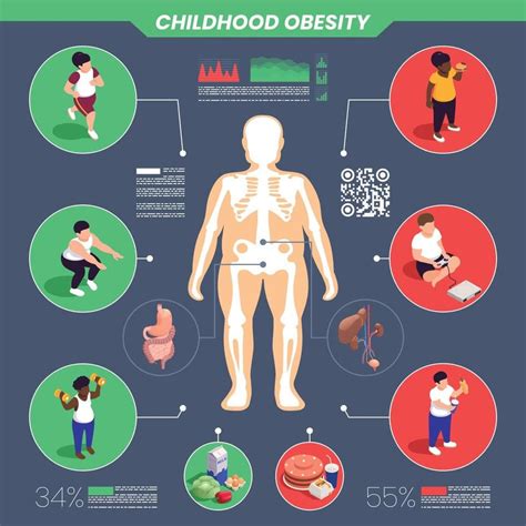 Childhood Obesity Infographic Set | Childhood obesity, Childhood, Child obesity