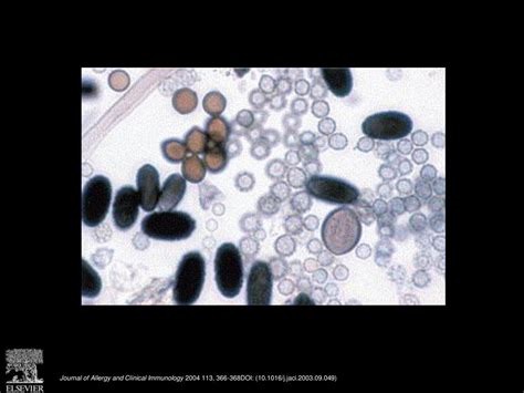 An atlas of fungal spores - ppt download