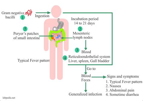 Enteric fever – part 2 – Paratyphoid fever, Salmonella paratyphi ...