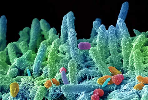 Autoimmune disorder lupus may be triggered by body’s bacteria | New Scientist