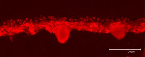 Horizontal cells – Retinal Microscopy