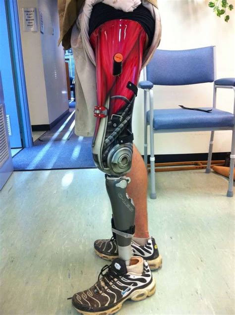 Fashion-Focused Prosthetics | Prosthetic leg, Orthotics and prosthetics, Prosthetics