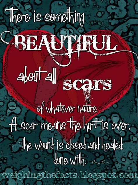 Inspirational Quotes On Scars. QuotesGram