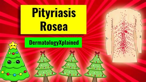 Pityriasis Rosea Christmas Tree Pattern