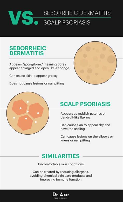 Seborrheic Dermatitis Causes + 7 Natural Treatments - Dr. Axe