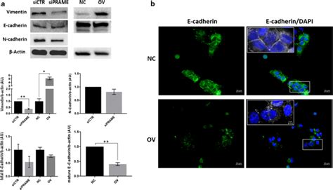 PRAME induces an epithelial-to-mesenchymal transition towards a more ...