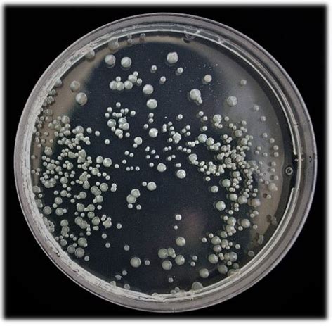 Plasmid DNA Isolation Protocol