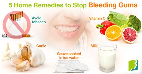 5 Home Remedies to Stop Bleeding Gums