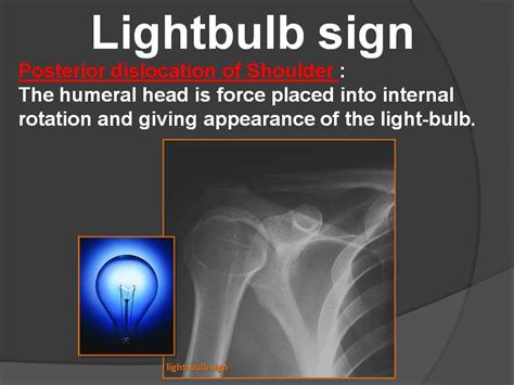 LIGHT BULB SIGN - Radiology Classroom