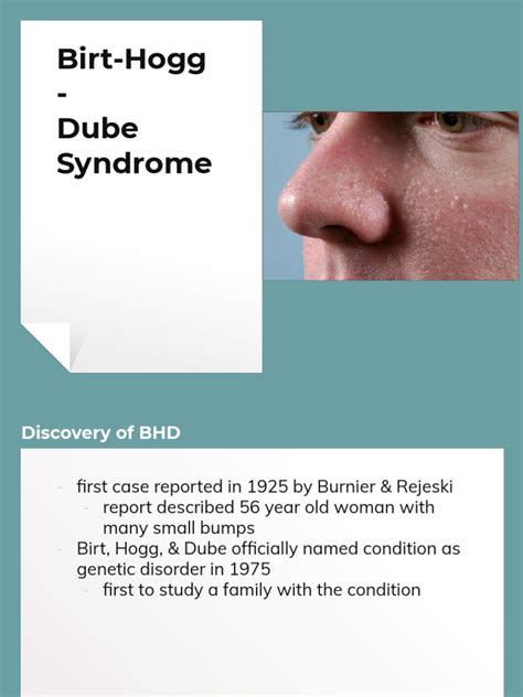 Birt-Hogg-Dube Syndrome PDF | PDF | Genetics | Clinical Medicine