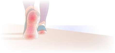 Heel Pain After Running and Prevention | WalkJogRun