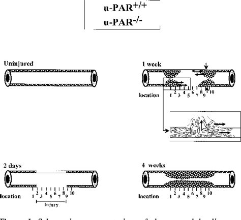 Figure 1 from Receptor-independent Role of Urokinase-Type Plasminogen Activator in Pericellular ...