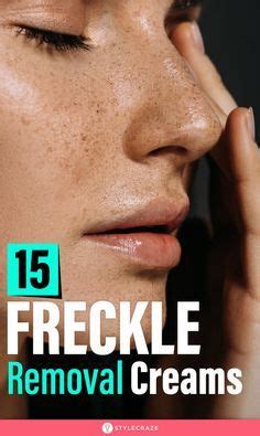 9 Best Freckle removal cream ideas | freckle removal cream, getting rid ...