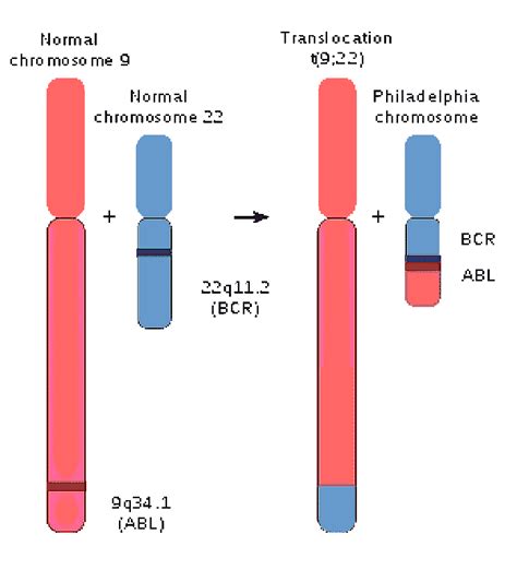 Chromosomes and Genetic Disorders | Musings in Biology