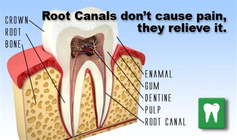 Pain After Root Canal Procedure: Will the Pain Disappear?