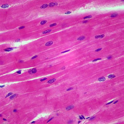 Mammal Cardiac Muscle, Sec. 7 M H&E Microscope Slide - Walmart.com