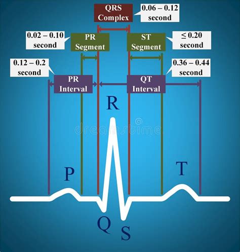 ECG or Electrocardiogram Showing Normal Time Duration Stock Illustration - Illustration of ...