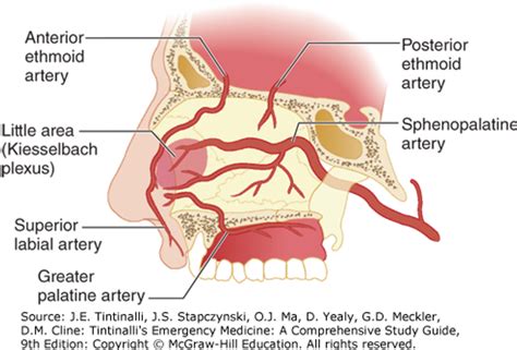 Epistaxis – Diagnosis : BC Emergency Medicine Network