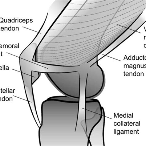 Tibial tuberosity–trochlear groove measurement. Notes: Tibial ...